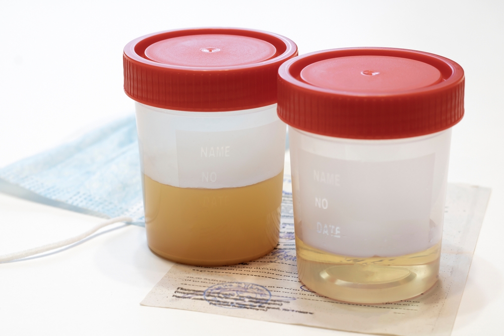 How can the color and odor of your urine help you know if you are properly hydrated